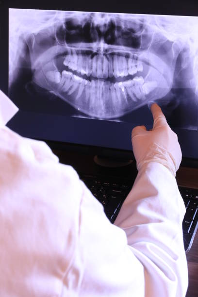 Best Mobile Emergency Dentist in Dundee, NY